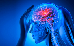 علامات تحذيريّة لا تهملها للسكتة الدماغية.. ستنقذ حياتك!