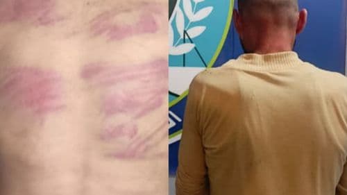 بالصور - ربط ابنته بالشجرة وعذبها وأخيها بأبشع الطرق.. متوحّش في بعبدا!