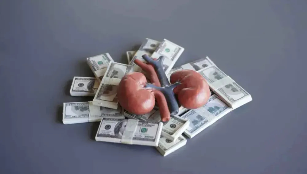 عرض كليته للبيع بـ35 ألف دولار.. فكانت نهايته صادمة!